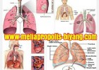 Mengatasi Penyakit Paru-paru Dan TBC
